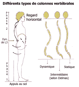 Différents types de colonnes vertébrales